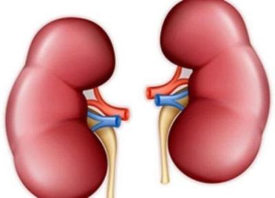 علائم سنگ کلیه را بشناسید علائم سنگ کلیه را بشناسید
